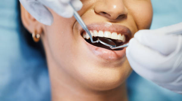 Best Teeth Whitening  in Moraine, OH