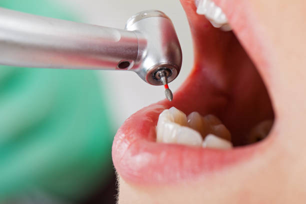 Best Urgent Tooth Repair  in Moraine, OH